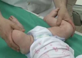 Kada i gde pregledati kukove beba