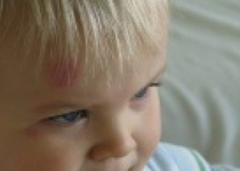 Povrede i padovi na odmoru