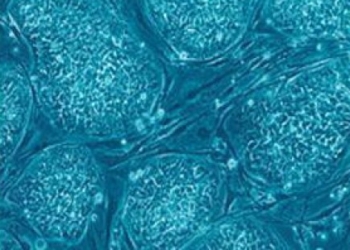 Transplantacija hematopoeznih matičnih ćelija