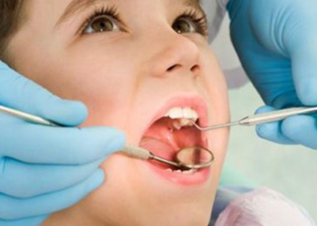 Zaštita zuba od karijesa