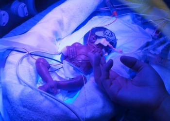 Ono što se desilo ovoj bebi teškoj manje od 700 grama ne može se rečima opisati