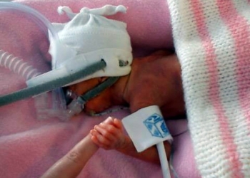 Emili od 500 grama: Najmanja beba, najveći borac za život