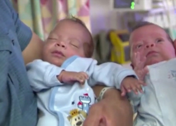 Dečak rođen 24 dana posle brata