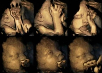 Bebe u stomaku beže od duvanskog dima