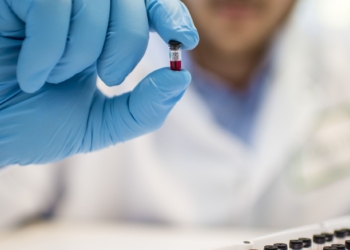 Brz test iz jedne kapi krvi