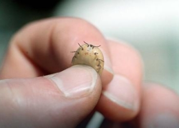 Reč epidemiologa: Najveću šansu da „zakače“ krpelja imaju deca