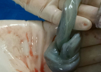 Lekar je na porođaju pozvao oca: Brzo ovo slikaj…