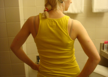 Ako vas bole leđa, vitamin B6 je obavezan