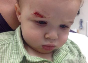 Saveti pedijatra: Kako pravilno obraditi ranu kada dete padne i povredi se