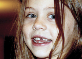 Čarolija Zubić vile