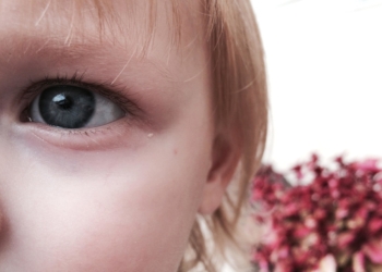 Mala razrokost teško se otkriva