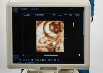 Vantelesna oplodnja posle vanrednog stanja