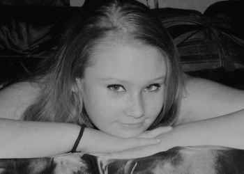 Promene na koži u pubertetu: Od mitisera do maljavosti