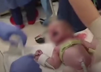 Magičan trenutak života: Snimljena pluća novorođenčeta pri prvom udisaju