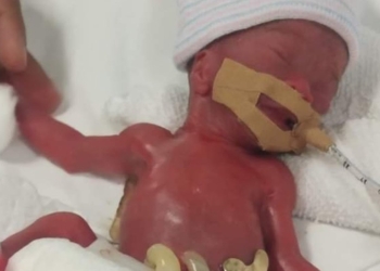 Najmanje novorođenče ide kući posle godinu dana provedenih u bolnici