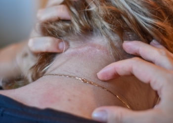 Prvi Sajam alergija u Srbiji – besplatni pregledi alergologa, pulmologa i dermatovenerologa