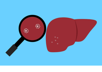 Prof. dr Ivana Milošević daje odgovore na pitanja o hepatitisu koja muče roditelje