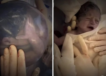 Neverovatan prizor bebe rođene u vodenjaku