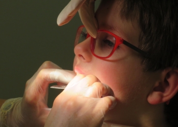 Kada je pravo vreme za uvođenje mobilne proteze?