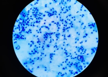 Nova studija pokazala: „Broj spermatozoida opao za 62 odsto“