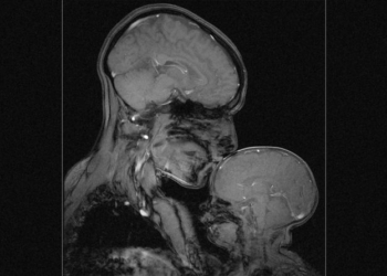 Nauka pokazala kako izgleda snažna veza majke i deteta