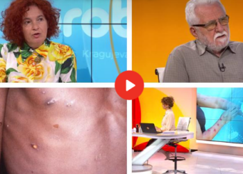 Majmunske boginje – da li je na pragu nova pandemija?