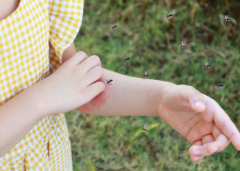 Od kog ujeda insekta možete imati alergijsku reakciju