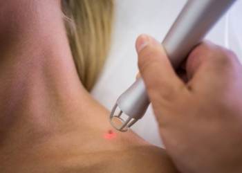 Mladeži kod dece: Kada je potreban pregled i da li je mladeže potrebno uklanjati?